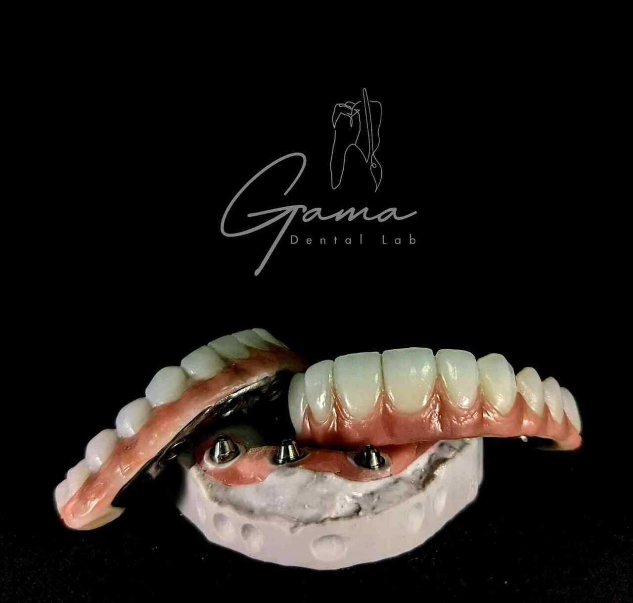 Prótesis sobre implantes - Gama Dental Lab