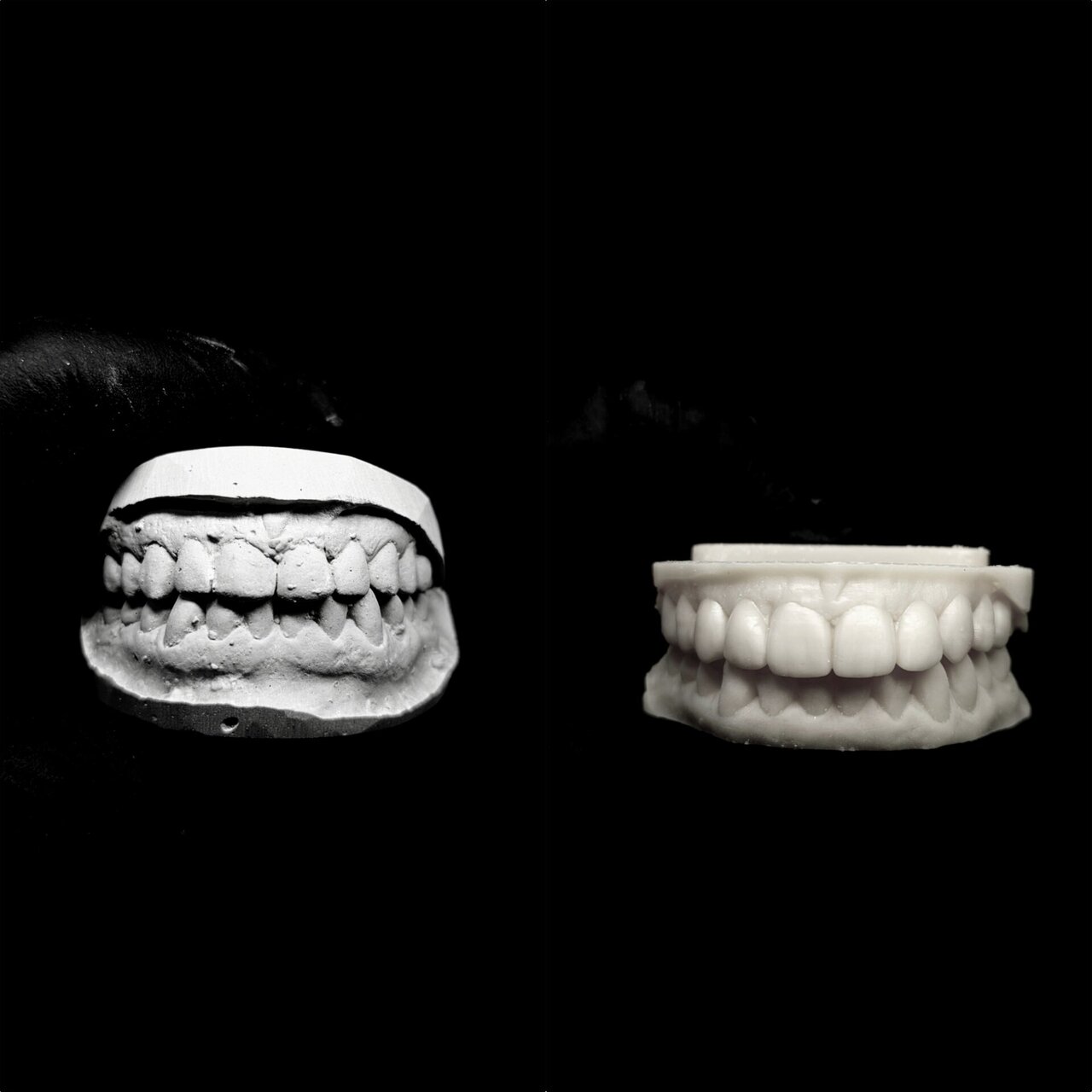 Modelo de yeso e impresión dental - Gama Dental Lab