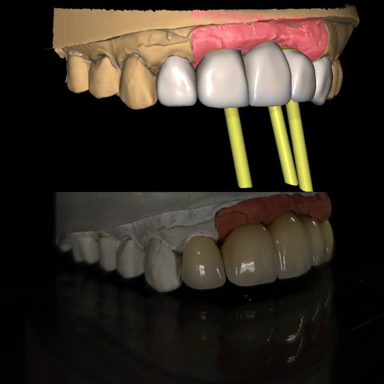 Flujo digital - Gama Dental Lab
