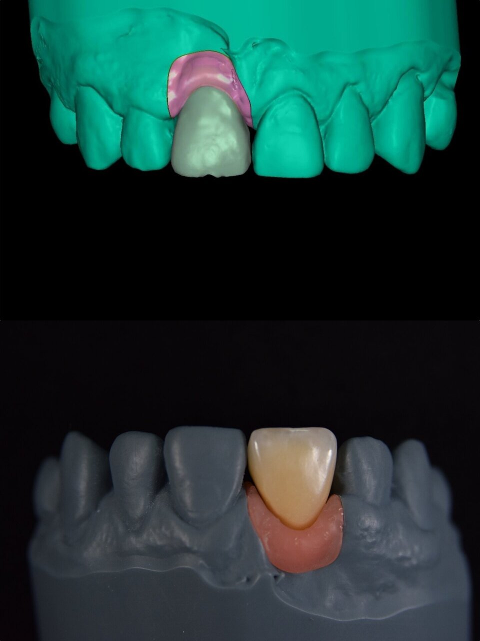 Prótesis dental - Gama Dental Lab
