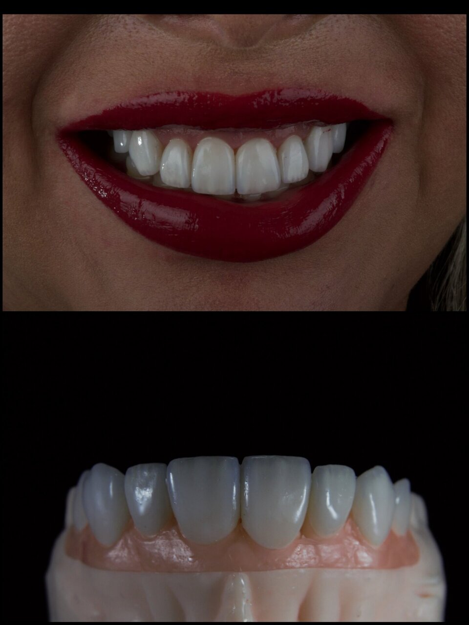 Diseño digital dental - Gama Dental Lab