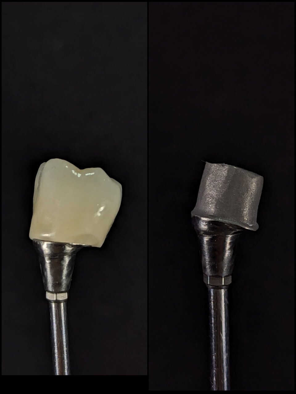 Aditamentos dentales - Gama Dental Lab